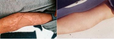 遼寧省近視治療醫(yī)院五佳榜單，這幾家醫(yī)院翹楚地位！