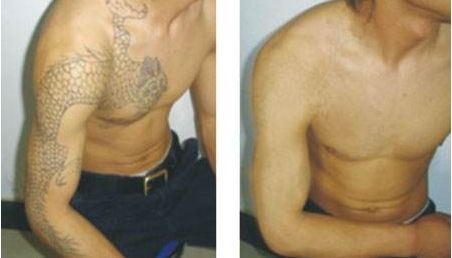 東莞市人民第六醫(yī)院整形科醫(yī)生團(tuán)隊(duì)及價(jià)格公開解析