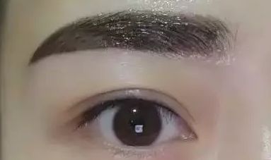 上海瑞格整形醫(yī)院領銜醫(yī)師羅瀾濤——重塑美麗眼睛的魔法使者，成功案例揭秘！