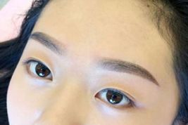 如何優(yōu)雅地?fù)碛须p眼皮？了解專家經(jīng)驗與最新案例！