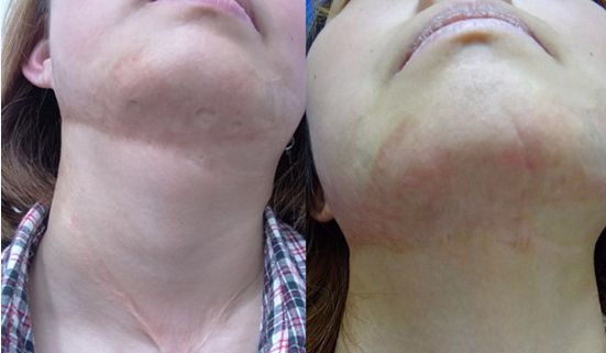 上海九院下頜角整形領(lǐng)域的知名醫(yī)師推薦！名醫(yī)師百人精選！