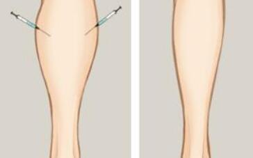 鄭州天后醫(yī)療美容醫(yī)院有哪些病例分享？