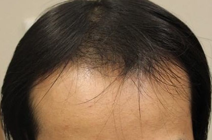 復(fù)旦大學(xué)附屬華山醫(yī)院是否提供整形手術(shù)服務(wù)？整形費(fèi)用如何？有哪些口碑醫(yī)生可供選擇？