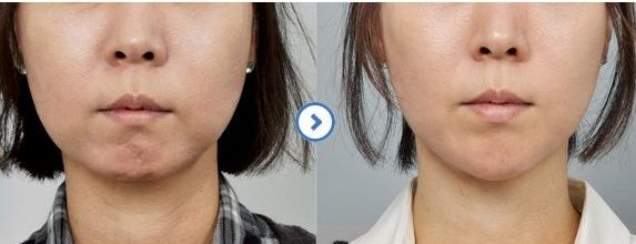 重慶市頂級整形醫(yī)院排行榜，了解領先醫(yī)療機構推薦列表