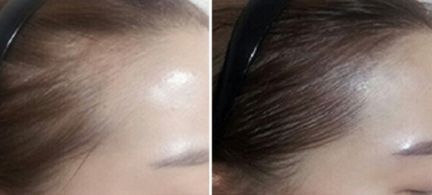 鄭州芳藝醫(yī)療整形醫(yī)院有沒有特色項目？如何一鍵獲取？