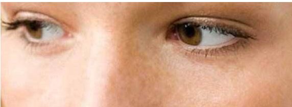 想改善雙眼皮？來(lái)鄭州三院看看王江允！了解費(fèi)用可參考2023價(jià)格表。