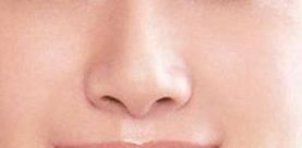 袁斯明醫(yī)生手術預約時效如何？祛疤效果有多好？解讀金陵醫(yī)院專家信息！