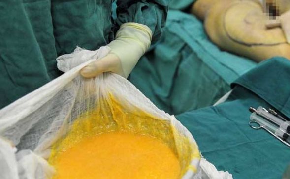 北京比較好的激光祛斑醫(yī)院推薦