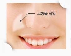 哈爾濱伊尚顏整形醫(yī)院項目如何？醫(yī)生技術(shù)是否可靠？