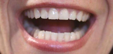 申霄與銀山：雙眼皮醫(yī)生大PK！誰更出彩？