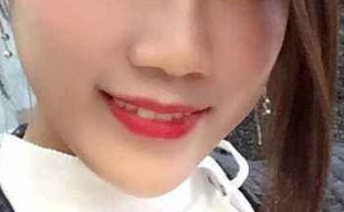 想要做隆鼻手術(shù)如何避免不好的經(jīng)歷？成功隆鼻必備指南！