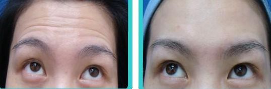 廣州市最受歡迎的私立整形醫(yī)院排行榜前十強