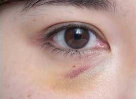 上海市那家醫(yī)療機構的鼻整形效果較好呢？