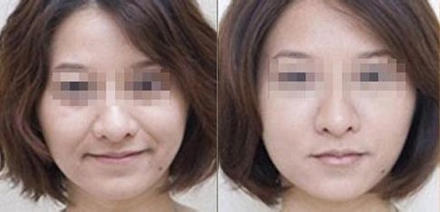 成都有哪些專業(yè)的雙眼皮整形醫(yī)生值得推薦？