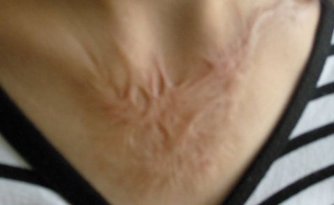 杭州著名雙眼皮醫(yī)生推薦，高口碑為你揭曉