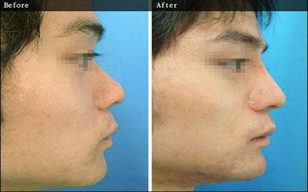 重慶軍科整形醫(yī)院是正規(guī)的嗎？吸脂怎么樣？醫(yī)生口碑評價揭曉了，真的靠譜嗎？能否滿足需求？