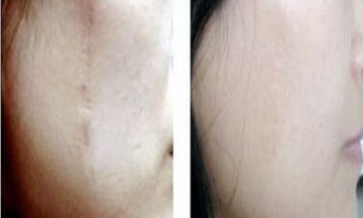 合肥專業(yè)磨骨手術(shù)醫(yī)院：醫(yī)術(shù)精湛，信譽(yù)有保障！