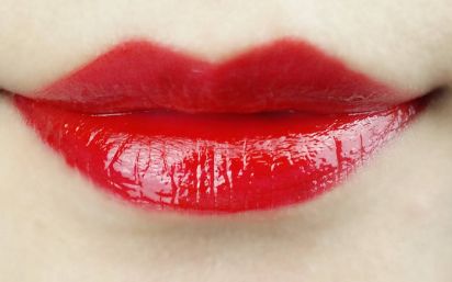 南京的施爾美整形醫(yī)院，讓孫欣恢復明亮清澈的雙眸