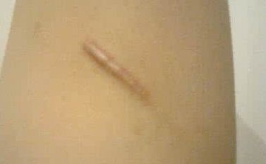 上海顧清整形哪家醫(yī)院好？看看口碑評價和隆鼻案例