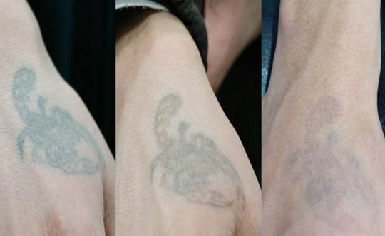 長沙哪家整形醫(yī)院技術(shù)靠譜？私立醫(yī)美還可信嗎？