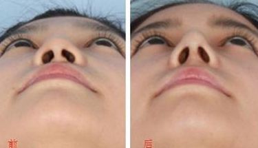 無錫市更受歡迎的吸脂醫(yī)院排行榜2023！這3家醫(yī)院赫然在列