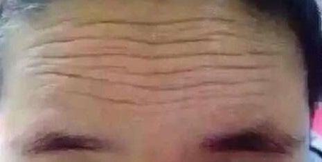 福州鼻部整形醫(yī)院排行榜：絕對讓你滿意的前十所醫(yī)院，信賴放心！