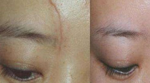 西京醫(yī)院美容科的醫(yī)師團(tuán)隊與隆鼻優(yōu)質(zhì)服務(wù)如何？