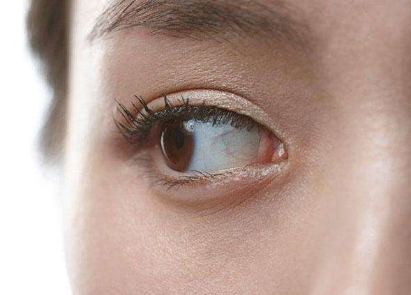 蘇州余道江隆鼻醫(yī)院費用如何？快來看看效果圖選擇參考