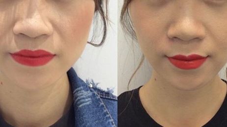 2023年熱議：揭秘重慶市當(dāng)?shù)貥O具口碑的整容醫(yī)院！