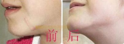 西安醫(yī)美：西京、唐都、高一生等醫(yī)院最受歡迎！最新榜單出爐！