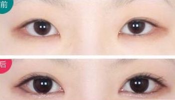 全國頂級整形醫(yī)院奉上前十年度最佳隆胸選擇！專業(yè)可靠服務，平價優(yōu)惠！