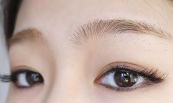 浙二醫(yī)院整形科包祺雙眼皮效果如何？專家簡(jiǎn)介及成功案例分享