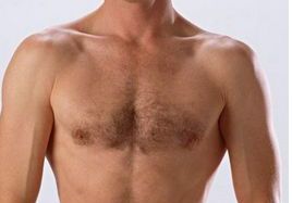 成都整容醫(yī)生吳開(kāi)泉鼻部整形手術(shù)真實(shí)案例！