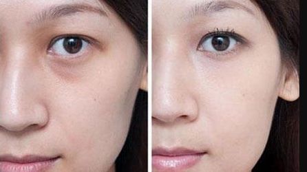 哪家醫(yī)院在大連揚名于胸部整形？