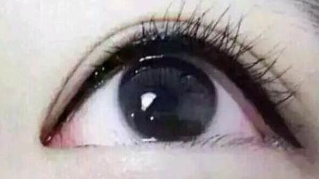 深圳哪家醫(yī)院割雙眼皮效果更好？值得推薦！