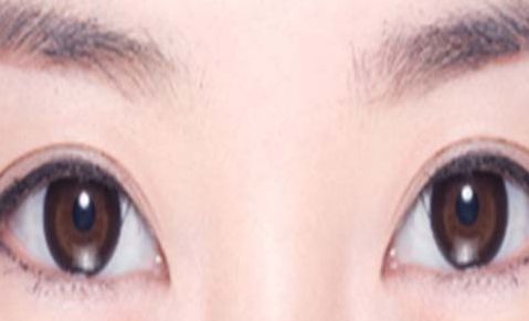 蘭州最受推薦的雙眼皮手術(shù)醫(yī)院你必須知道