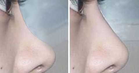 無錫最新醫(yī)美熱門！高人氣整形醫(yī)院揭秘，信譽在線！