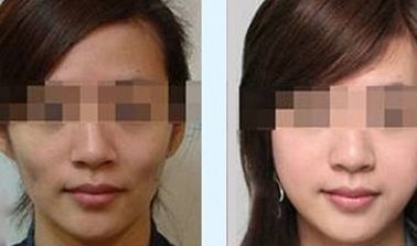 京城創(chuàng)新！北京隆鼻專家前十強(qiáng)揭曉：專業(yè)實(shí)力過(guò)人，代表強(qiáng)勢(shì)入圍！