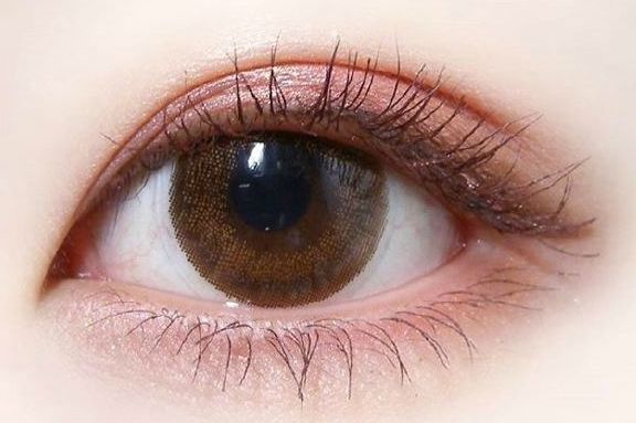 做雙眼皮的技術(shù)及效果，近年治療體驗(yàn)發(fā)布解析