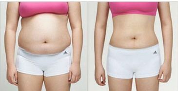 廣州優(yōu)秀整形醫(yī)院排名前三，看看美恩、荔醫(yī)、曙光的口碑如何