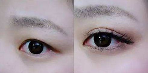 上海九院張英為雙眼皮手術(shù)的明星醫(yī)生，獨(dú)具醫(yī)術(shù)絕技。