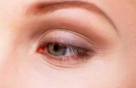 衡陽隆胸哪家醫(yī)院技術高深值得信賴？求推薦