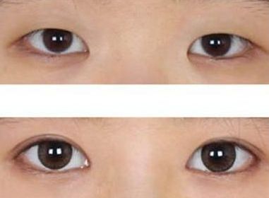 廣州市七家口碑卓越的面部提升醫(yī)院榮登排行榜