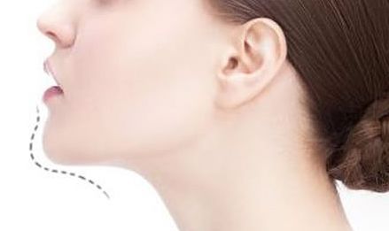 威海市各大醫(yī)療機(jī)構(gòu)綜合排名，揭秘最信賴的雙眼皮手術(shù)醫(yī)院