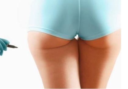 廣州權(quán)威吸脂醫(yī)院推薦，技術(shù)卓越不可錯(cuò)過(guò)！