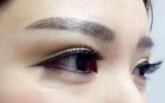 2023年最受認(rèn)可的國內(nèi)拉皮手術(shù)醫(yī)生排行榜，頂尖專家名單公布