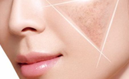 卿勇隆鼻效果如何？專家所屬醫(yī)院披露