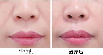 最靠譜的蘇州下頜角整形醫(yī)院推薦，口碑爆棚的醫(yī)療機(jī)構(gòu)評選