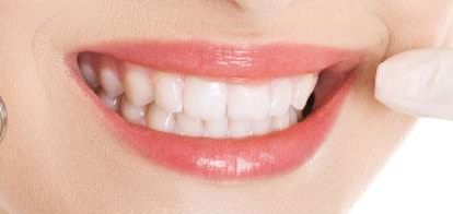 2023年一覽廈門最新雙眼皮醫(yī)療機構-替代列表中，星系、顏王等上榜，自主選擇美容服務！