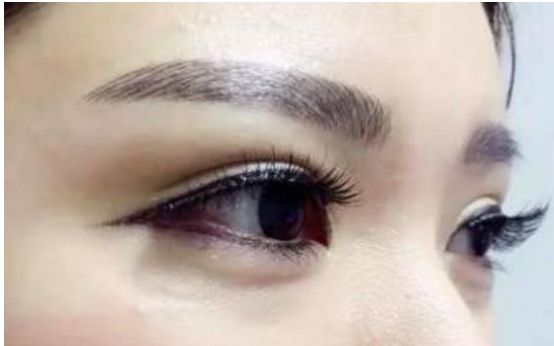 經(jīng)驗(yàn)豐富！華西地區(qū)雙眼皮重點(diǎn)醫(yī)生推薦，名單揭秘！